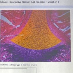 Nervous tissue histology pal practical question highlighted lab solved answers identify