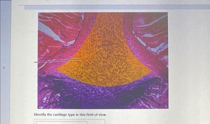 Nervous tissue histology pal practical question highlighted lab solved answers identify