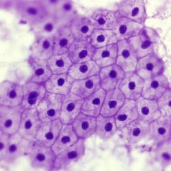 Epithelium squamous simple histology membranous cell cells blood vessels nucleus lining heart layer single