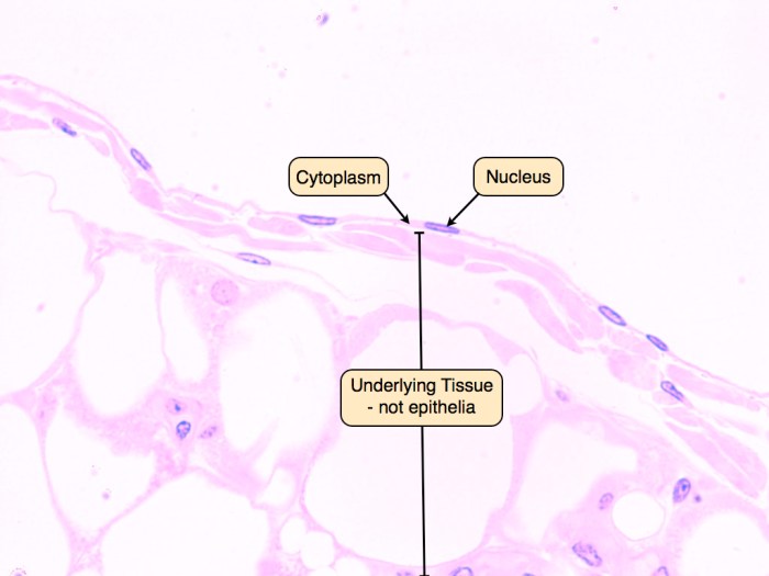 Simple squamous epithelium drawing with label